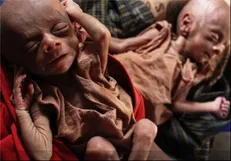 سازمان ملل: حمله به مسلمانان روهینگیا مشکوک به «نسل‌ کُشی» است