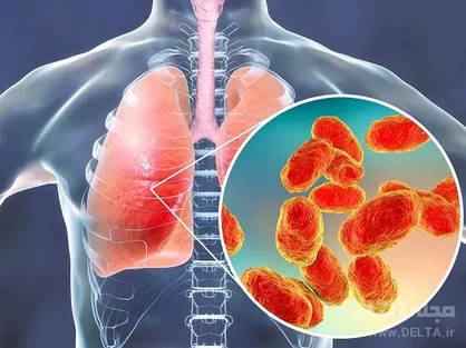 چرا ویروس کرونا فقط بعضی از ارگان&zwnj;ها را درگیر می&zwnj;کند؟