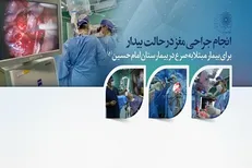 انجام جراحی مغز در حالت بیدار برای بیمار مبتلا به صرع در بیمارستان امام حسین(ع)