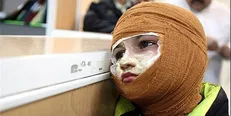 مصدومیت ۲۲۷ نفر بر اثر انفجار مواد محترقه/ سه نفر جان باختند
