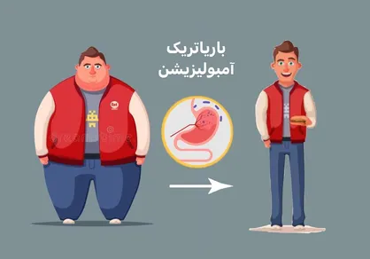 بستن رگ اشتها؛ روش بدون سند علمی و پرخطر برای بیماران چاق/ خطری در کمین بیماران چاق با بستن رگ اشتها