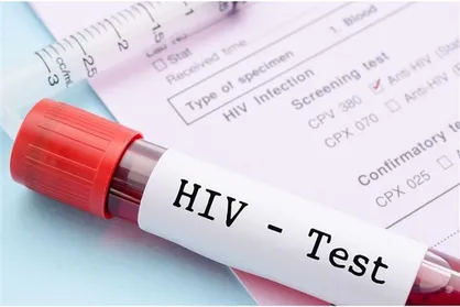 چهار مرکز غربالگری رایگان HIV در البرز فعال شد