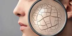 محققان تبریزی ژلی برای بهبود چین و چروک پوست تولید کردند