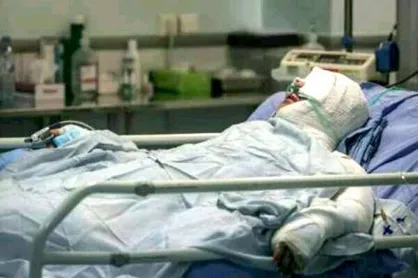 انجمن حمایت از بیماران سوخته| سوختگی در ایران ۸ برابر میانگین جهانی