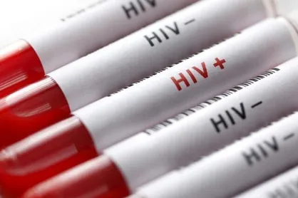 &laquo;مصرف تفننی مواد&raquo; و &laquo;رفتار&zwnj;های جنسی پرخطر&raquo; عامل اصلی افزایش ریسک HIV
