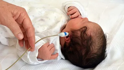 سالانه ۴۰۰ هزار کودک محروم و روستایی غربالگری رایگان شنوایی می&zwnj;شوند