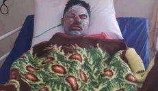 فعال محیط زیست کهگیلویه و بویراحمد بر اثر سوختگی شدید فوت شد