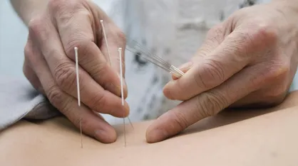 رشته جدید طب سوزنی به آزمون دکتری تخصصی سال ۱۳۹۹ افزوده شد