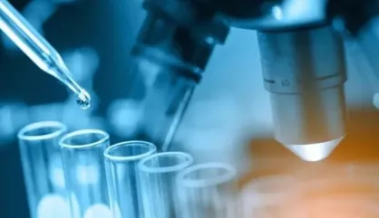 بومی&zwnj;سازی نانوکاتالیست&zwnj;های پیشرفته واحد RCD در کشور