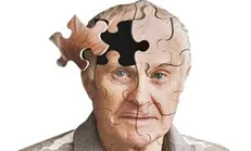 تشخیص به موقع آلزایمر از طریق فناوری ایرانی