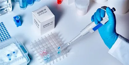 اجرای طرح تست آنتی بادی از کارکنان شهرداری تهران