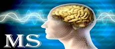 سالانه ۳ تا ۵ هزار نفر به بیماران مبتلا به MS افزوده می‌شود/ نقش تأثیرگذار سیگار در بروز بیماری MS