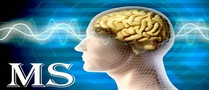 سالانه ۳ تا ۵ هزار نفر به بیماران مبتلا به MS افزوده می&zwnj;شود/ نقش تأثیرگذار سیگار در بروز بیماری MS