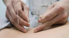 زمان برگزاری آزمون ارزشیابی رشته طب سوزنی اعلام شد