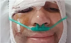 «امیر کربلایی‌زاده» از بیمارستان مرخص شد
