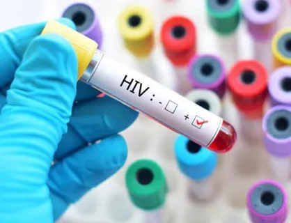 تغییر الگوی انتقال HIV/بیش از 44 هزارنفر اچ&zwnj;آی&zwnj;وی مثبت هستند