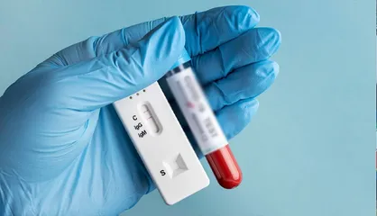 حمایت از توسعه فناوری کیت&zwnj;های تشخیص HIV