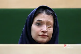 حضور قربانیان حوادث اسیدپاشی در مجلس