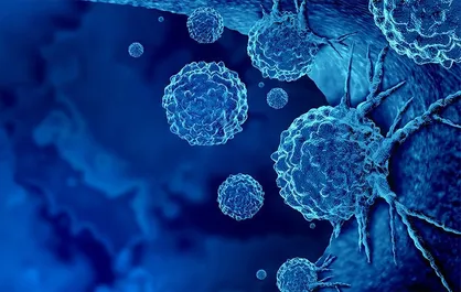 خدمات مرتبط با سرطان در مراکز دولتی مشمول بسته های حمایتی است