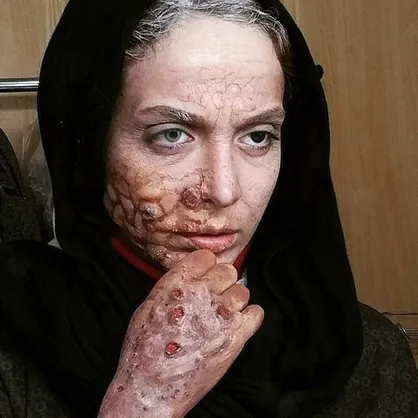 چرا مهناز افشار باید دادگاهی شود؟