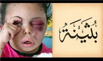 صلیب سرخ خواستار بازگشایی مرزهای یمن به روی غذا و دارو شد