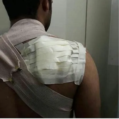 کارگر سلف دانشگاه شهرکرد دانشجوی معترض به کیفیت غذا را به باد کتک گرفت
