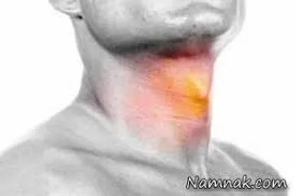 گرفتگی صدا را جدی بگیرید/ آنچه در مورد سرطان حنجره باید بدانید