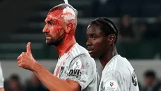 ۱۲ بخیه برای سردار دورسون؛ مهاجم سابق پرسپولیس با چهره خونین هم تسلیم نشد