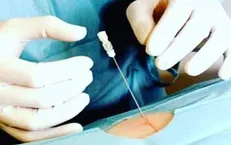 واردات دستگاه اُزن‌تراپی ممنوع شد
