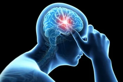 سن بروز سکته مغزی در جامعه ما حدود ۱۰ سال کاهش یافته است