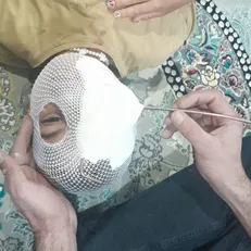 چشم کودک اردبیلی در حادثه‌ای با میله فلزی آسیب دید