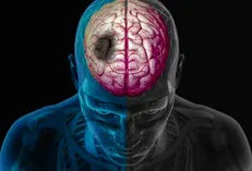 چگونه زمستان خطر سکته مغزی را افزایش می‌دهد؟