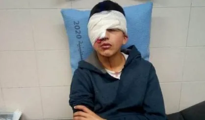 شلیک مستقیم به چشم نوجوان فلسطینی +فیلم