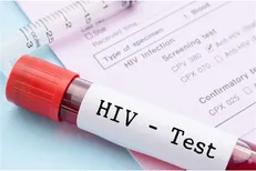 چهار مرکز غربالگری رایگان HIV در البرز فعال شد