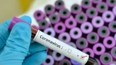 اینفوگرافیک اقدامات پیشگیرانه دانشگاه گلستان برای مقابله با کرونا منتشر شد