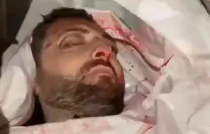 شهادت خبرنگار الجزیره در حمله رژیم صهیونیستی به غرب غزه