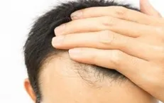 ۷ ماده غذایی برای افزایش رشد مو