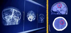 راه‌ حل جدید پژوهشگران دانشگاه تهران برای افزایش امنیت هوش مصنوعی در تحلیل MRI مغز