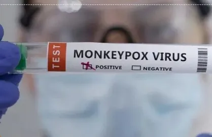 تجهیز ۱۲ آزمایشگاه تشخیص آبله میمونی