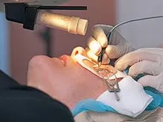 شرایط عمل لیزر برای‬ افراد‬ عینکی / حدود ‏۲۵ تا ۵۰ درصد جامعه عینک نیاز دارند