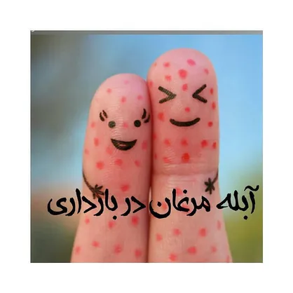 خطرات ابتلا به ویروس آبله مرغان در دوران بارداری