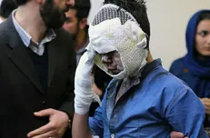 سه قطع عضو و ۱۷۱ مصدوم/تلخ‌ترین پیامد حوادث چهارشنبه‌سوری در همدان