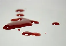 «نزاع» ۵۷۵ هزار نفر را به پزشکی قانونی کشاند