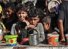 سوءتغذیه چه بر سر کودکان غزه می‌آورد؟