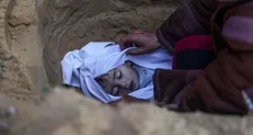افزایش تأمل‌برانگیز تولد نوزادان نارس در غزه