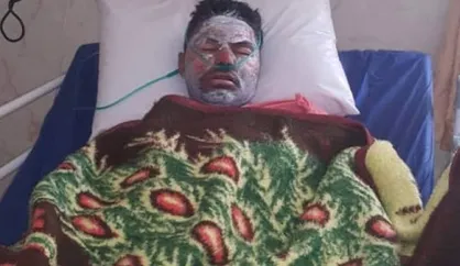 فعال محیط زیست کهگیلویه و بویراحمد بر اثر سوختگی شدید فوت شد