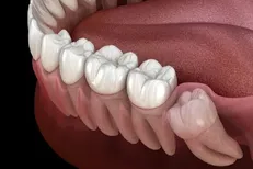 ارتباط سلامت ضعیف دهان و دندان با مشکلات مزمن سلامت