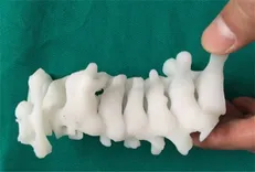 ضایعات نخاعی به کمک استخوان مصنوعی درمان می‌شود