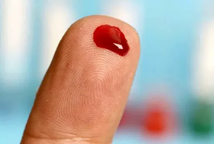 نشانه&zwnj;های &laquo;پُرخونی&raquo; چیست؟
