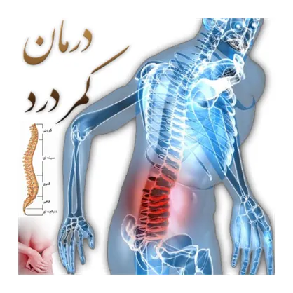 فیلم/ راه&zwnj;های درمان کمر درد